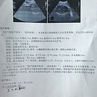 各位帮忙看看这张b超单 是男宝还是女宝啊