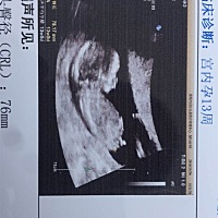 这肚子下面的小突起，是男孩的意思吗，请教各位宝妈们？