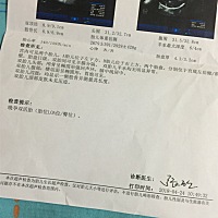 再熬四天，缷货！真心觉得撑得好累！