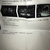 昨天突然流血，去检查了下照的b超，说已经没有发育了，我的天都塌下来了，想问下大家这种情况是不是孩子...