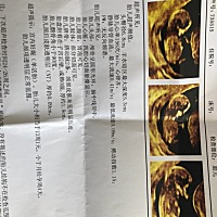 能看出男孩还是女孩吗？