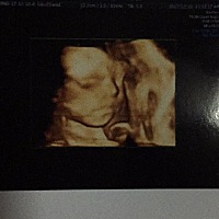 四维跟出生的样子还真是一模一样