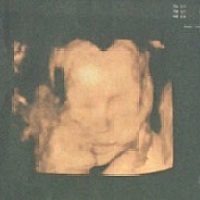 39 3脐带绕颈两周，想顺产，但是宝宝一点动静没有，急啊！40周一过能不能催产啊？