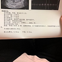 孕92天，做的NT，想让大家帮我看看男孩女孩～