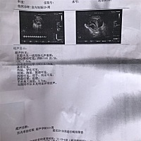 大家看看，是男孩还是女孩！