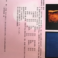 新鲜的四维出炉啦，医生说是个圆脸胖宝宝👶！大家猜猜是男宝还是女宝，我已经知道是什么啦