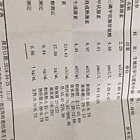 帮我看下检验单有没有问题。最近月经量比较少就去检查了一下。 谢谢