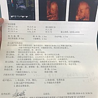 这是二宝，才做的四维，一切正常，大家能看出来是男宝还是女宝吗？