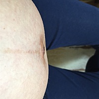 我的肚几眼怎么这样鼓的啊