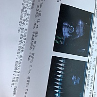 第二次产检  有懂得宝妈没  帮忙看看