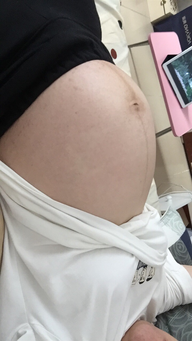 生产前一天的肚子