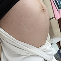 我觉得自己恢复的还挺快，第三天肚子开始慢慢消没用收腹带，一开始用了下勒的难受就没用了。可能一直上...