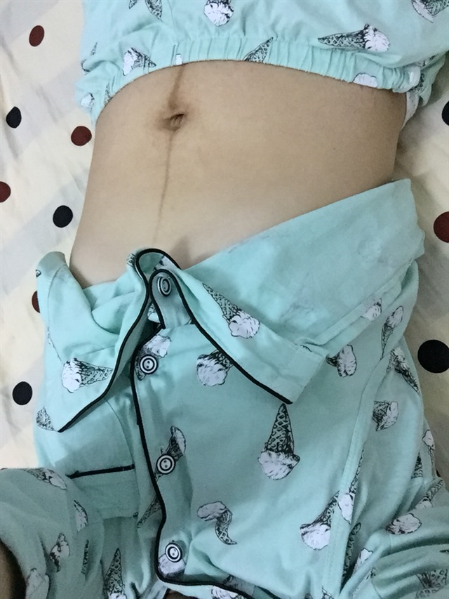 生产后第十五天的肚子