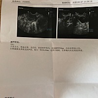 各位我想请问下这个是快排卵了吗？我问医生什么时候会排卵。医生只说你这两天可以试着怀孕了。我都搞不...