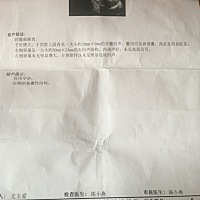 有人会看是男宝还是女宝的吗？就是第一次生孩子好好奇！男包女宝都可以！就是想知道