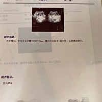 帮看孕囊数据男宝女宝