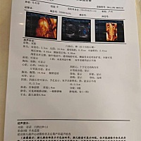 双胞胎，看男女，好奇，这是 做的四维