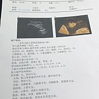 有没有宝妈做三维左心室探及强回声斑的 做三维的医生叫我自己看单子 不愿意透漏 产检得一个月后 很担心
