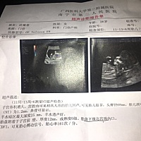 各位晚上好，第一胎很好奇性别。懂得大家帮忙看看是公主还是少爷，谢谢各位啦