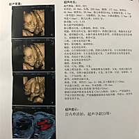 四维顺利归来，大家猜猜看男孩女孩呀……