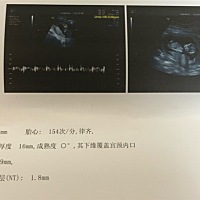 怀孕快4个月了，大家帮我看一下b超男孩女孩