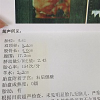 是不是个女娃娃，医生说大鼻子大嘴巴🤣