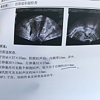 11号来月经，7天，大家帮我看看是排过了？有没有别的问题？