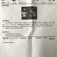 孕囊形状可以看男女吗？请问我这是什么形状？