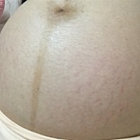 39 1，肚子长妊娠纹啦，55555
