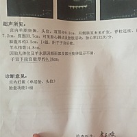 可以看出来男孩女孩吗？