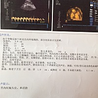 姐妹👭们 帮忙看看男孩女孩？