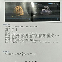 宝妈们 男孩女孩啊 第一胎。