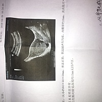 我大姨妈推迟半个月去查b超和血都没有怀孕 试纸也显示没有怀孕 去查了内分泌说有点紊乱 我就觉得是月经...