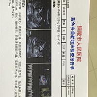 h男孩还是女孩啊