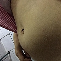 停经8天，到现在还没有来月经，肚子一下帐这样子是正常吗，