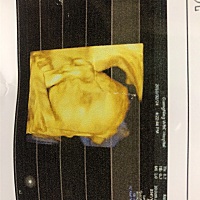 男宝女宝  求鉴定    怎么看的