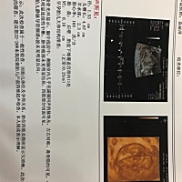 帮忙看下男宝还是女宝