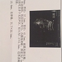 想要小孩去检查，医生给开了个子宫附件B超，结果这样，影响要孩子吗？病的严重吗？