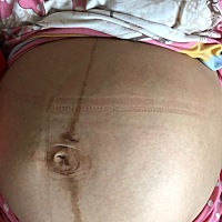 后天39周，医生说一胎刨腹产这次检查该住院啦、希望宝宝健健康康、好害怕、