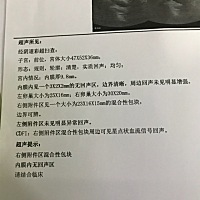 有没有宝妈之前有宫外孕保守治疗后好孕的？我现在这个情况医生说手术也可以保守治疗也可以，我都不知道...