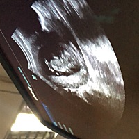 宝宝今天在肚子里面刚刚100天了。很期待宝宝的到来。