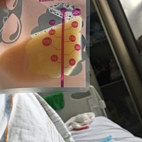 能顺产千万不要刨腹产，生完后真是爽到爆，疼，小宝宝还在保温箱，一直没有见到她，想她，一定加油，给...