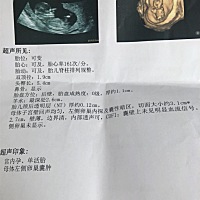 能看出男宝女宝吗