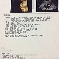 大家帮忙看看是男宝还是女宝