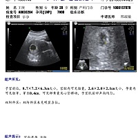 有姐妹会看孕囊男女吗