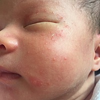 有人知道宝宝脸上长的什么吗？