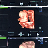 四维照片，大家看看像男孩女孩啊