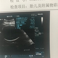 宝妈帮我看看，上面数据显示1313克，什么意思？是宝宝体重吗？我现在是孕34周