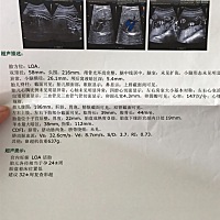 怀孕24周四维，猜男宝女宝，长得跟老公超像。
