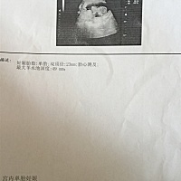 听说B超单圆形是女的，长形茄子型是男的，我这个这么圆是女的吗？